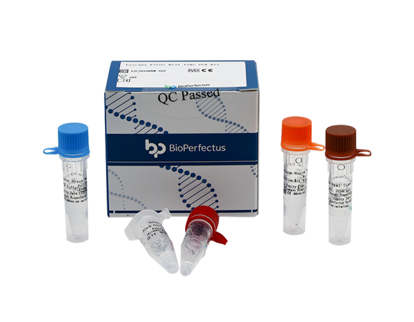 Toscana Virus Real Time PCR Kit