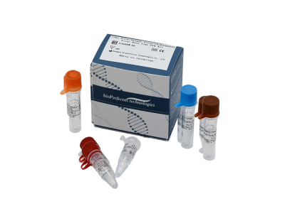 Zika Virus/Dengue Virus/Chikungunya Virus Virus Real Time PCR Kit