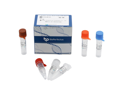 Dengue Virus Type 3 & Type 4 Real Time PCR Kit